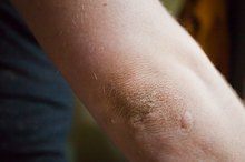 How to Clean Dark Elbows