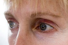 Cause of Dark Spot in the Center of Vision