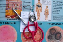 How Long Does It Take to Heal a Second Degree Burn?