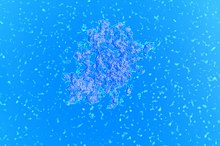 What Are the Treatments for Serratia Bacteria?