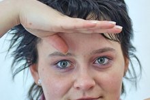 How to Get Rid of Acne Pock Marks