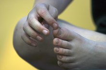 How to Protect a Toe With No Nail