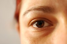 Antibiotics for an Eye Infection