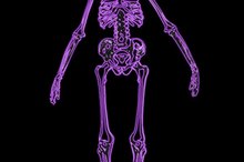 What Do White Spots on a Bone Scan Indicate?