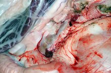 What Is Erythematous Mucosa in the Rectum?