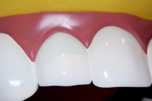 Cons of Wearing an Occlusal Splint