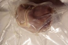 Advantages and Disadvantages of Organ Donation