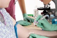 High Bilirubin Levels in Adults