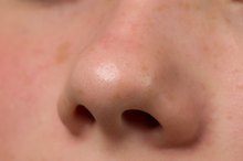 What Are the Causes of a Red Nose?