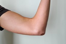 How to Remove Mold From the Body Naturally
