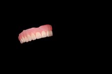 How to Hold Dentures in Without an Adhesive