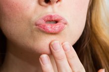 How to Use Coconut Oil for Chapped Lips