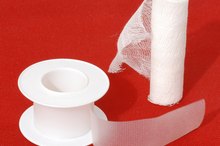 How to Treat a Burn Bubble