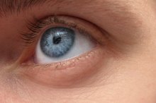 How to Get Rid of a Sty on Your Eye