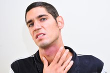 How to Get Rid of Rash Marks