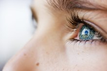 How to Treat a Swollen Eyelid