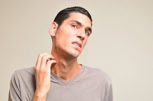 How to Get Rid of Bird Mites on a Human