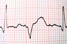 What Are the Four Parts of the EKG Machine?