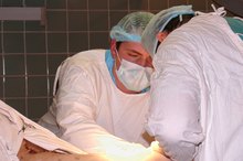Types of Surgical Glue