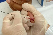 Difference Between O Positive & O Negative Blood