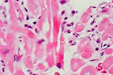 Incubation Time for Urinary Tract Infections
