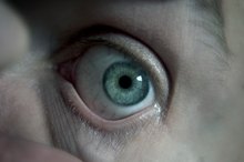 What Causes Calcium Deposits in the Eye?
