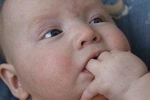 Skin Discoloration on Kids