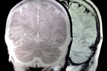 Left Frontoparietal Functions in the Brain