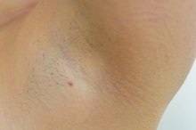 Little Red Bumps After Shaving