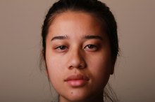 How to Reduce Eyelid Puffiness