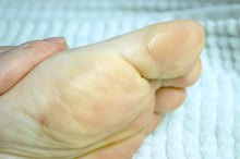 Creams for Hard Skin Removal