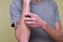 How to Get Rid of Scratch Scars