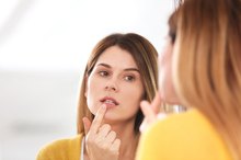 Hydrogen Peroxide & Cold Sores