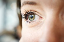 How to Remove Warts Around the Eye