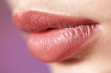 What Are the Treatments for Cheilitis?