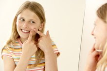 How to Get Rid of Acne Scars and Big Pores
