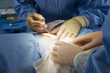 Why Does Blood Pressure Drop During Surgery?