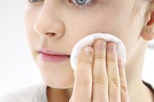 Bactroban Ointment for Pimples