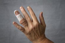 Recovering From Finger Surgery