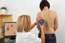Actinic Keratosis Vs. Seborrheic Keratosis