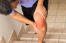 Ligament Tear & Knee Hyperextension