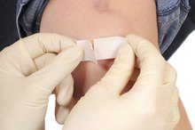 Will Abrasion Wounds Heal Faster Uncovered?