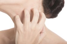Itchy Skin From Phentermine