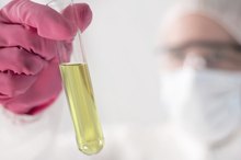 Normal Urinary Output for an Adult