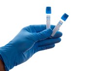 How Does Sodium Citrate Work?