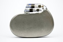 Advantages & Disadvantages of a Pacemaker
