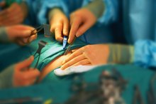 Food Permitted to Eat After Intestinal Surgery