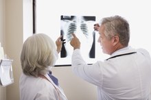 What Are the Symptoms at the End Stage of Lung Cancer?