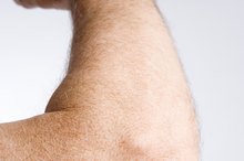 Elbow Skin Pain