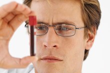 Normal DHEA Sulfate Levels in Men